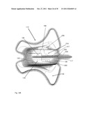 STABILIZATION DEVICE diagram and image