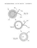 CATHETERS WITH LUBRICIOUS LININGS AND METHODS FOR MAKING AND USING THEM diagram and image