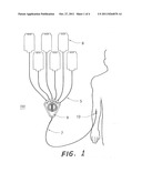 DEVICE FOR INFUSION OF PRESCRIPTION MEDICINES OR TREATMENTS diagram and image