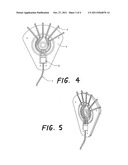 DEVICE FOR INFUSION OF PRESCRIPTION MEDICINES OR TREATMENTS diagram and image