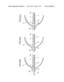 BALLOON CATHETER SYSTEM diagram and image