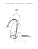 BALLOON CATHETER SYSTEM diagram and image