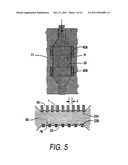 MEDICAL INSTRUMENTS AND TECHNIQUES FOR TREATING PULMONARY DISORDERS diagram and image