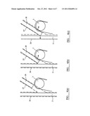 EXTERNAL FIXATION CLAMP diagram and image