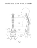 MINIMALLY INVASIVE SYSTEMS, DEVICES, AND SURGICAL METHODS FOR PERFORMING     ARTHRODESIS IN THE SPINE diagram and image