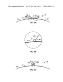 Surgical Device diagram and image