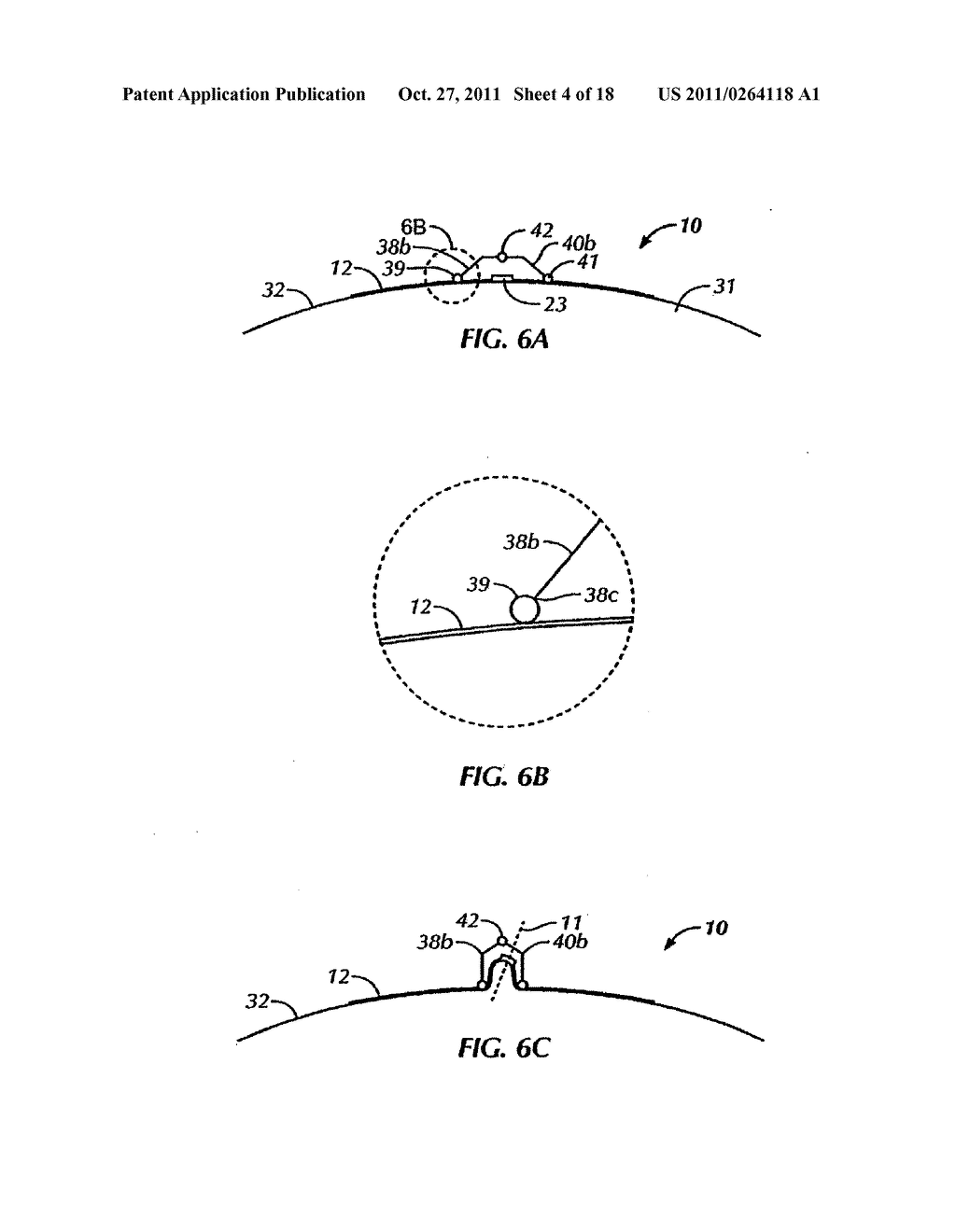 Surgical Device - diagram, schematic, and image 05