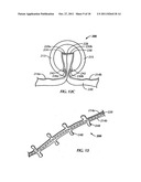 Surgical Device diagram and image