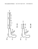 Surgical Device diagram and image