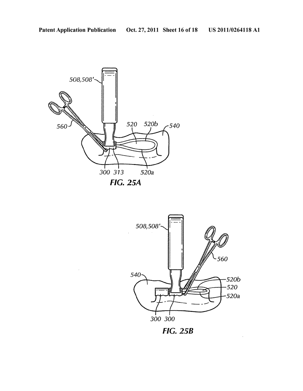 Surgical Device - diagram, schematic, and image 17