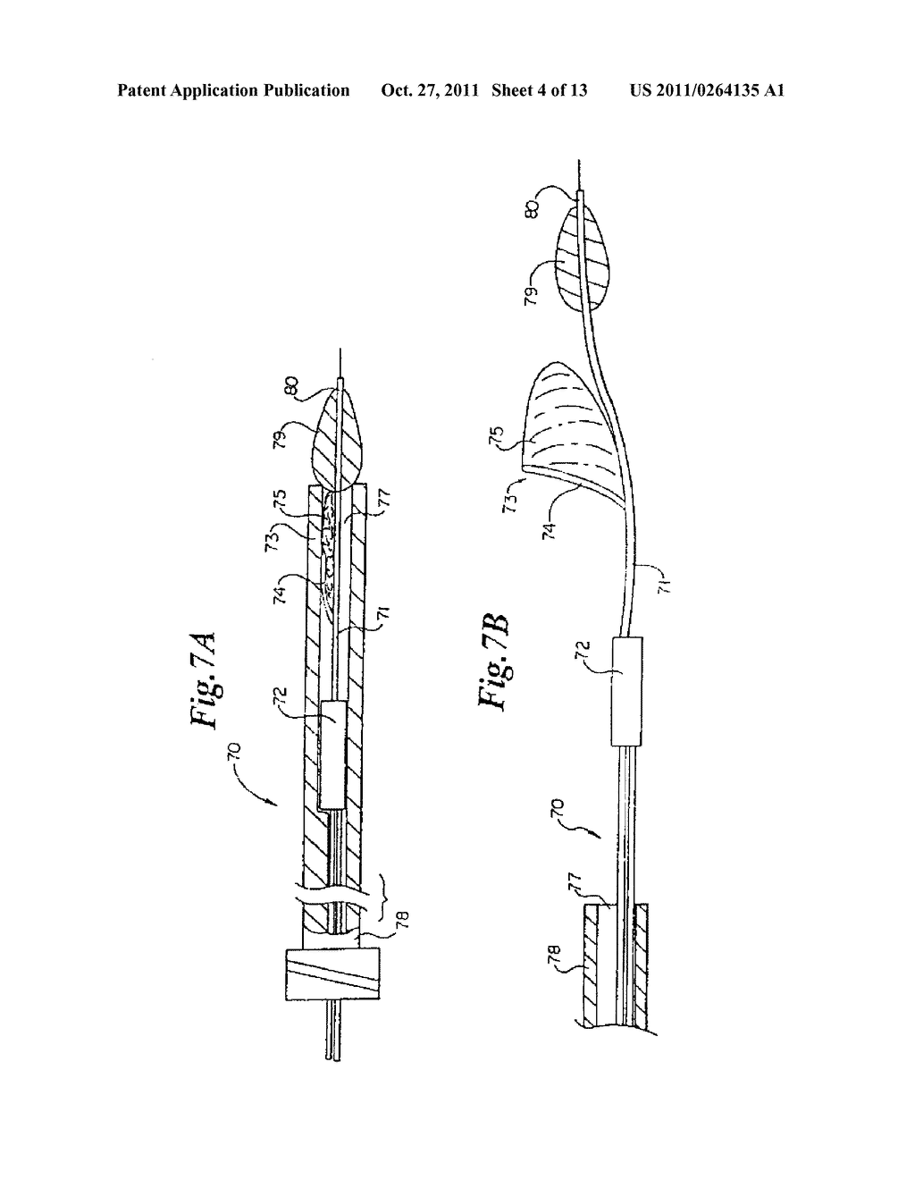 VASCULAR DEVICE FOR EMBOLI AND THROMBI REMOVAL AND METHODS OF USE - diagram, schematic, and image 05