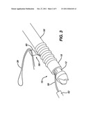 KNOTLESS SUTURE ANCHOR diagram and image