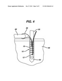 KNOTLESS SUTURE ANCHOR diagram and image