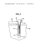 KNOTLESS SUTURE ANCHOR diagram and image