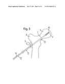 DEVICE FOR FIXATION OF BONE FRAGMENTS AT BONE FRACTURES diagram and image