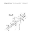 DEVICE FOR FIXATION OF BONE FRAGMENTS AT BONE FRACTURES diagram and image