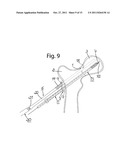 DEVICE FOR FIXATION OF BONE FRAGMENTS AT BONE FRACTURES diagram and image