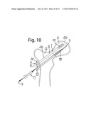 DEVICE FOR FIXATION OF BONE FRAGMENTS AT BONE FRACTURES diagram and image