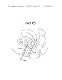 System and Method for Nerve Stimulation diagram and image