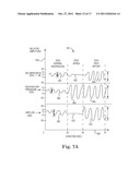 METHOD OF TREATING SLEEP DISORDERED BREATHING diagram and image