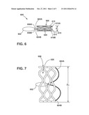 Endoluminal Implant With Locking and Centering Fixation System diagram and image