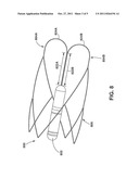 Endoluminal Implant With Locking and Centering Fixation System diagram and image