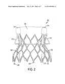 Prosthetic Valve with Sealing Members and Methods of Use Thereof diagram and image