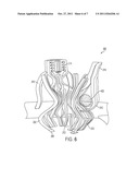 Prosthetic Valve with Sealing Members and Methods of Use Thereof diagram and image