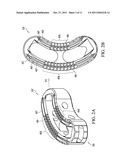 INTERVERTEBRAL BODY IMPLANT, INSTRUMENT AND METHOD diagram and image