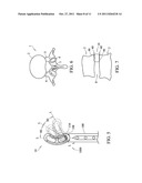 INTERVERTEBRAL BODY IMPLANT, INSTRUMENT AND METHOD diagram and image