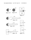 METHODS AND APPARATUS FOR TREATING DISC HERNIATION AND PREVENTING THE     EXTRUSION OF INTERBODY BONE GRAFT diagram and image