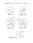 METHODS AND APPARATUS FOR TREATING DISC HERNIATION AND PREVENTING THE     EXTRUSION OF INTERBODY BONE GRAFT diagram and image