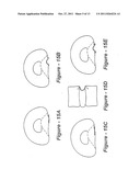 METHODS AND APPARATUS FOR TREATING DISC HERNIATION AND PREVENTING THE     EXTRUSION OF INTERBODY BONE GRAFT diagram and image