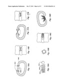 METHODS AND APPARATUS FOR TREATING DISC HERNIATION AND PREVENTING THE     EXTRUSION OF INTERBODY BONE GRAFT diagram and image