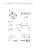 METHODS AND APPARATUS FOR TREATING DISC HERNIATION AND PREVENTING THE     EXTRUSION OF INTERBODY BONE GRAFT diagram and image