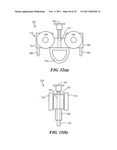 Patient positioning system and rail for use therein diagram and image