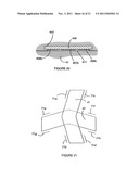 DETECTOR FOR DETECTING A GRAVITY GRADIENT diagram and image