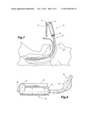 Endo-tracheal intubation device with adjustably bendable stylet diagram and image