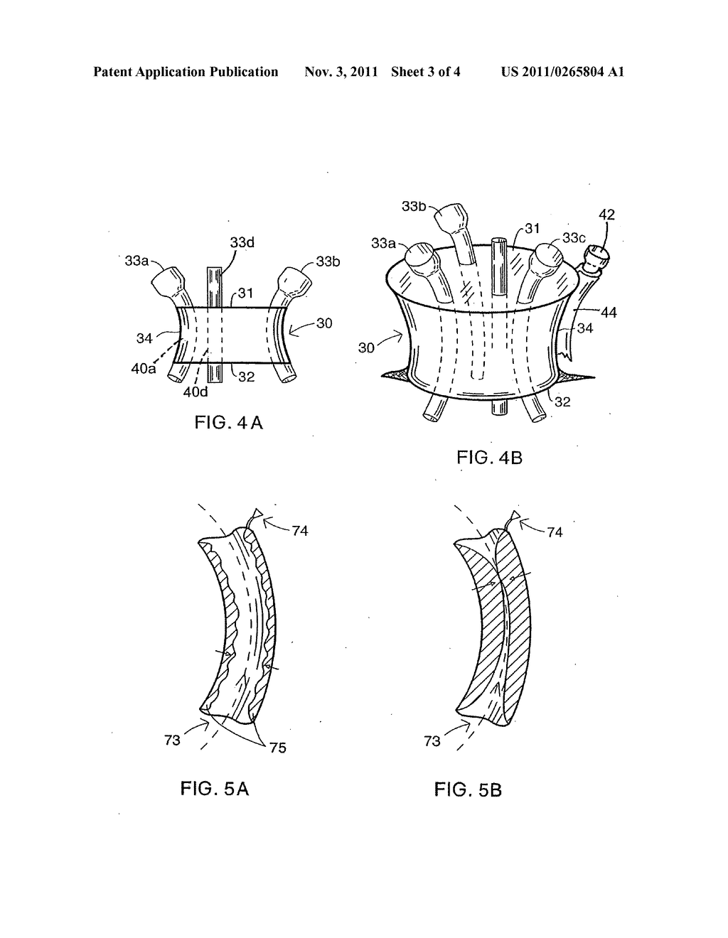 Laparoscopic instruments and trocar systems and related surgical method - diagram, schematic, and image 04