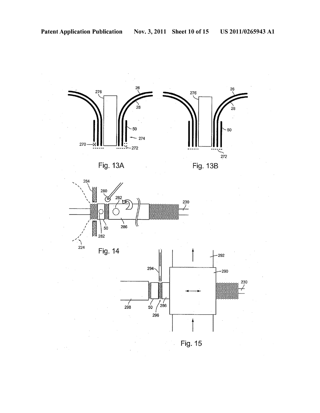 Methods For Making Braid-Ball Occlusion Devices - diagram, schematic, and image 11