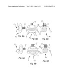 NOZZLE ARRANGEMENT diagram and image