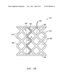 Pixel structure for microbolometer detector diagram and image