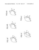 VEHICLE OCCUPANT RESTRAINT SYSTEM COMPRISING AN INFLATABLE GAS BAG diagram and image