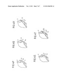 VEHICLE OCCUPANT RESTRAINT SYSTEM COMPRISING AN INFLATABLE GAS BAG diagram and image