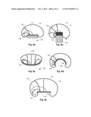 ION BEAM EXTRACTION BY DISCRETE ION FOCUSING diagram and image