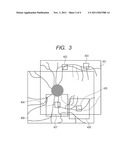 CHARACTERISTIC IMAGE EXTRACTION METHOD AND OPHTHALMOLOGIC APPARATUS diagram and image