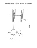 ORTHOVOLTAGE RADIOTHERAPY diagram and image