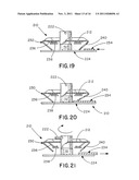 Releasable Barb Assembly diagram and image