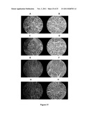 PROBIOTIC STRAIN AND ANTIMICROBIAL PEPTIDE DERIVED THEREFROM diagram and image