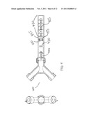 Apparatuses, Systems and Methods For Efficient Solubilization Of Carbon     Dioxide In Water Using High Energy Impact diagram and image